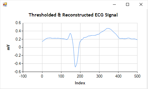 Detail Filtered ECG Signal