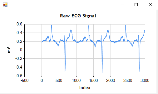 Raw ECG Signal